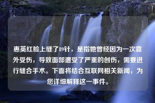 惠英红脸上缝了89针，是指她曾经因为一次意外受伤，导致面部遭受了严重的创伤，需要进行缝合手术。下面将结合互联网相关新闻，为您详细解释这一事件。